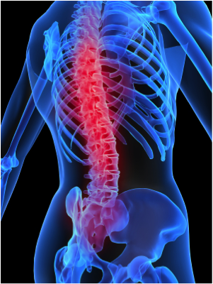 back pain