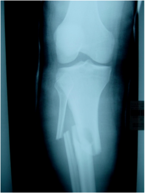 injury prevention